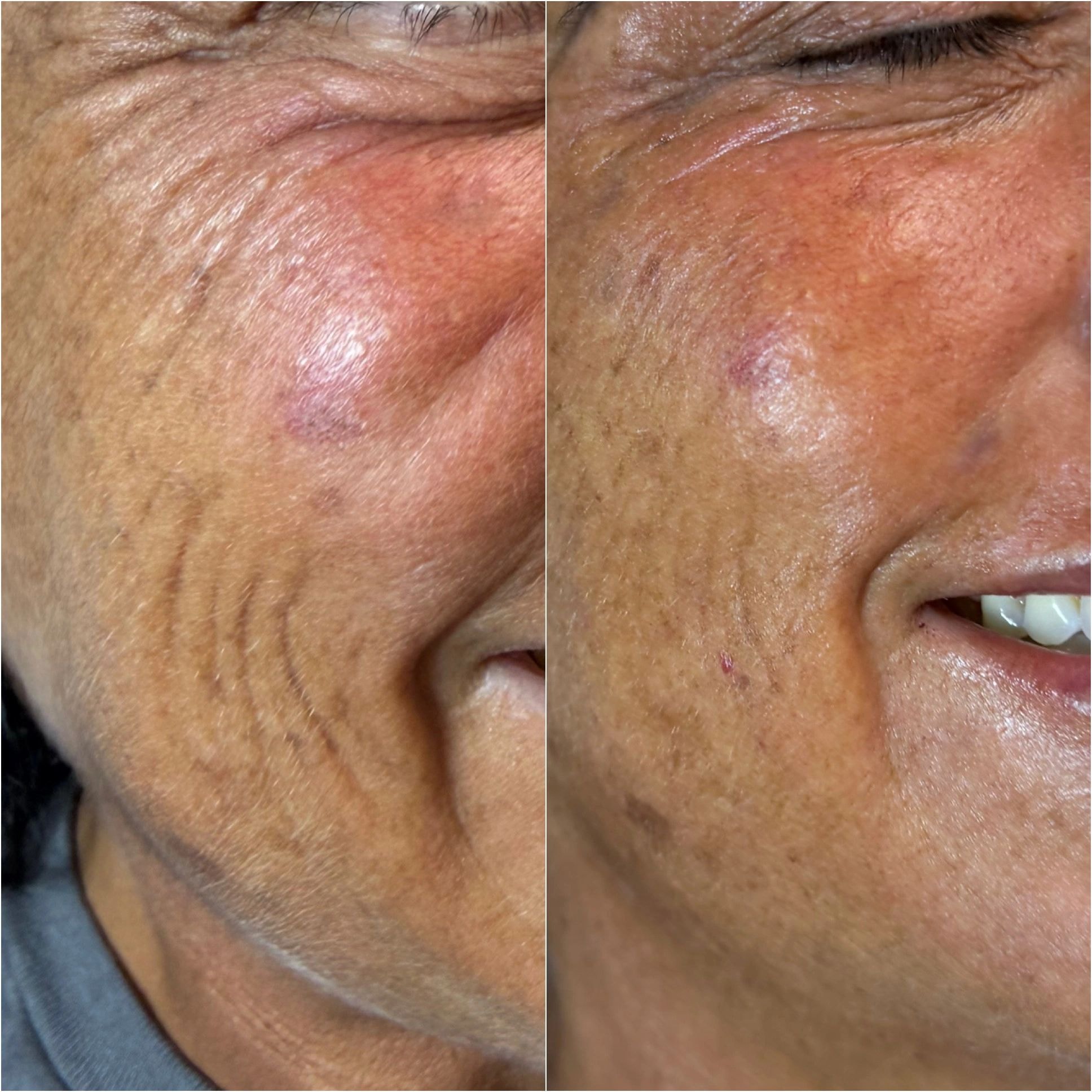 Before & After